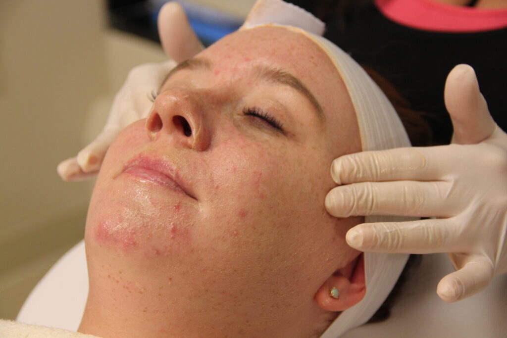Facials in Short Hills, NJ